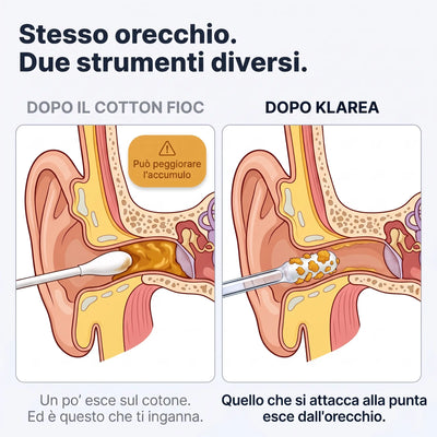 Klarea Pro® Bastoncino adesivo per orecchie